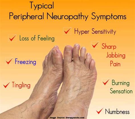 Small Fiber Neuropathy: Symptoms, Treatment,。